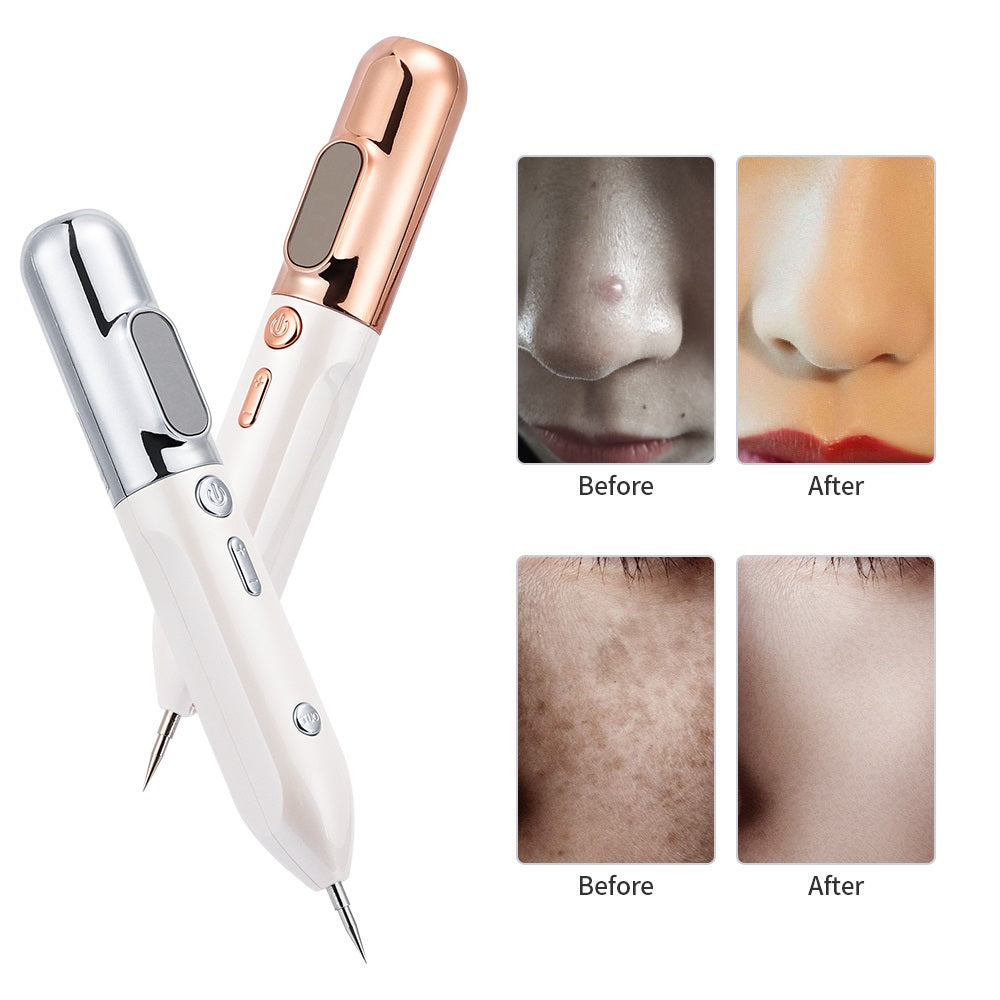 HexoPen️ Wart & Skin Tag Removal Plasma Pen