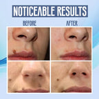 Facial Hair Removal Pen