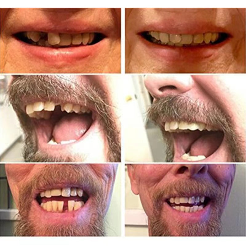 High-quality false teeth