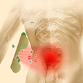 Pain-relieving heat pads for the back