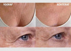 Anti-Wrinkle Silicone Pads