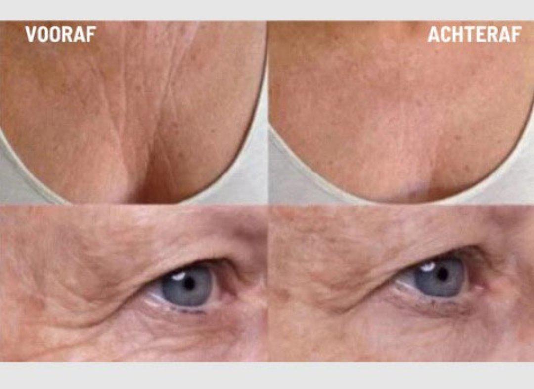 Anti-Wrinkle Silicone Pads