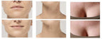 Anti-Wrinkle Silicone Pads