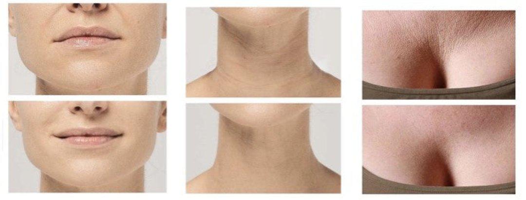 Anti-Wrinkle Silicone Pads