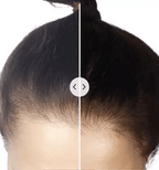 5-in-1 hair comb with massage & light therapy for healthier hair