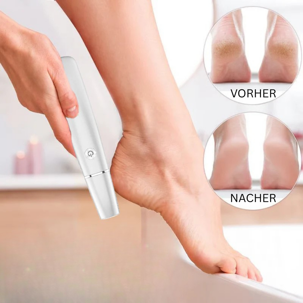 Electric Callus Remover for the Feet