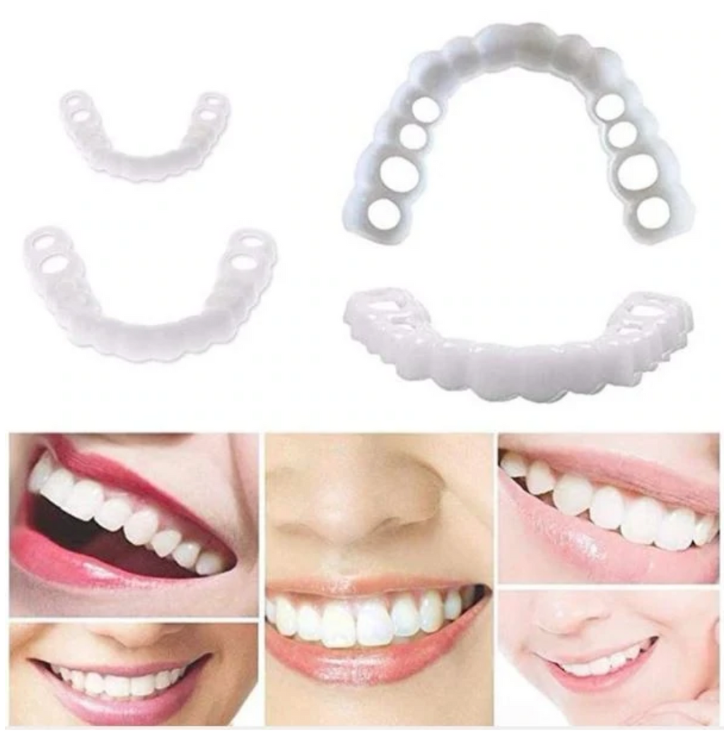 HappySmile Facet set | Reusable upper and lower facets for a radiant smile