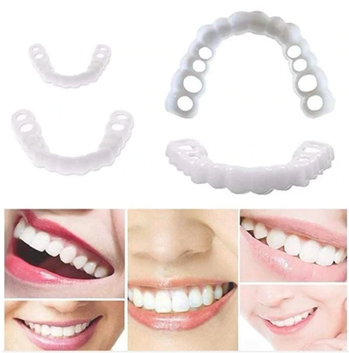 HappySmile Facet set | Reusable upper and lower facets for a radiant smile