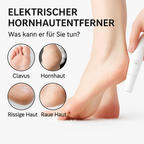 Electric Callus Remover for the Feet