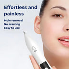 ClearSkinPro Laser Plasma Pen - Non-Invasive | for Freckle, Skin Tag, Spot, Mole and Tattoo Removal at Home
