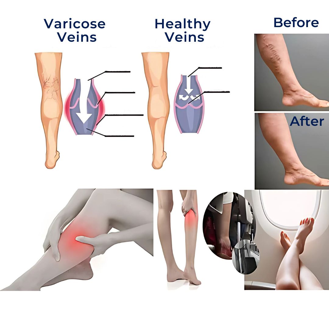 CircuEase Compression Socks | Soft, Highly Elastic Design for Muscle Recovery & Circulation Enhancement for Professionals on Their Feet