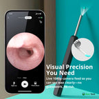 EarScope Pro Ear Wax Removal Kit | High-Resolution Camera & LED Lights for Safe Home Use