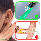 EarScope Pro Ear Wax Removal Kit | High-Resolution Camera & LED Lights for Safe Home Use