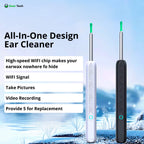 EarScope Pro Ear Wax Removal Kit | High-Resolution Camera & LED Lights for Safe Home Use