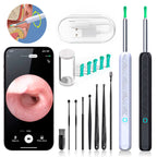 EarScope Pro Ear Wax Removal Kit | High-Resolution Camera & LED Lights for Safe Home Use