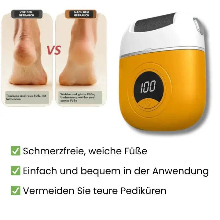 Electric callus remover for smooth feet
