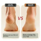 Electric callus remover for smooth feet