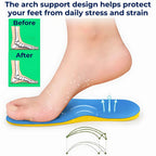 FootAlign Supination Insoles for Underpronation | Orthopedic Insoles - Foot Support - Daily Comfort