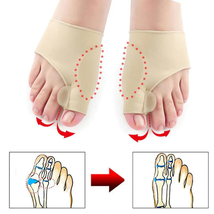Hallux-Valgus-Correction Protection (1 Pair)