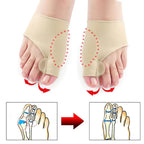 Hallux-Valgus-Correction Protection (1 Pair)