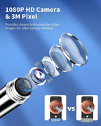 HD Earwax Removal Spoon — Wireless Otoscope with LED Light