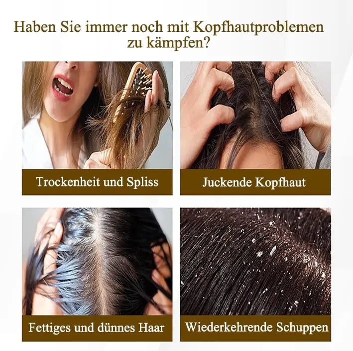 Scalp Massage Comb – Gentle Dandruff Removal & Care