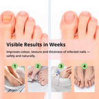 Laser Nail Treatment Device – Red and aulight against Nail Fungus