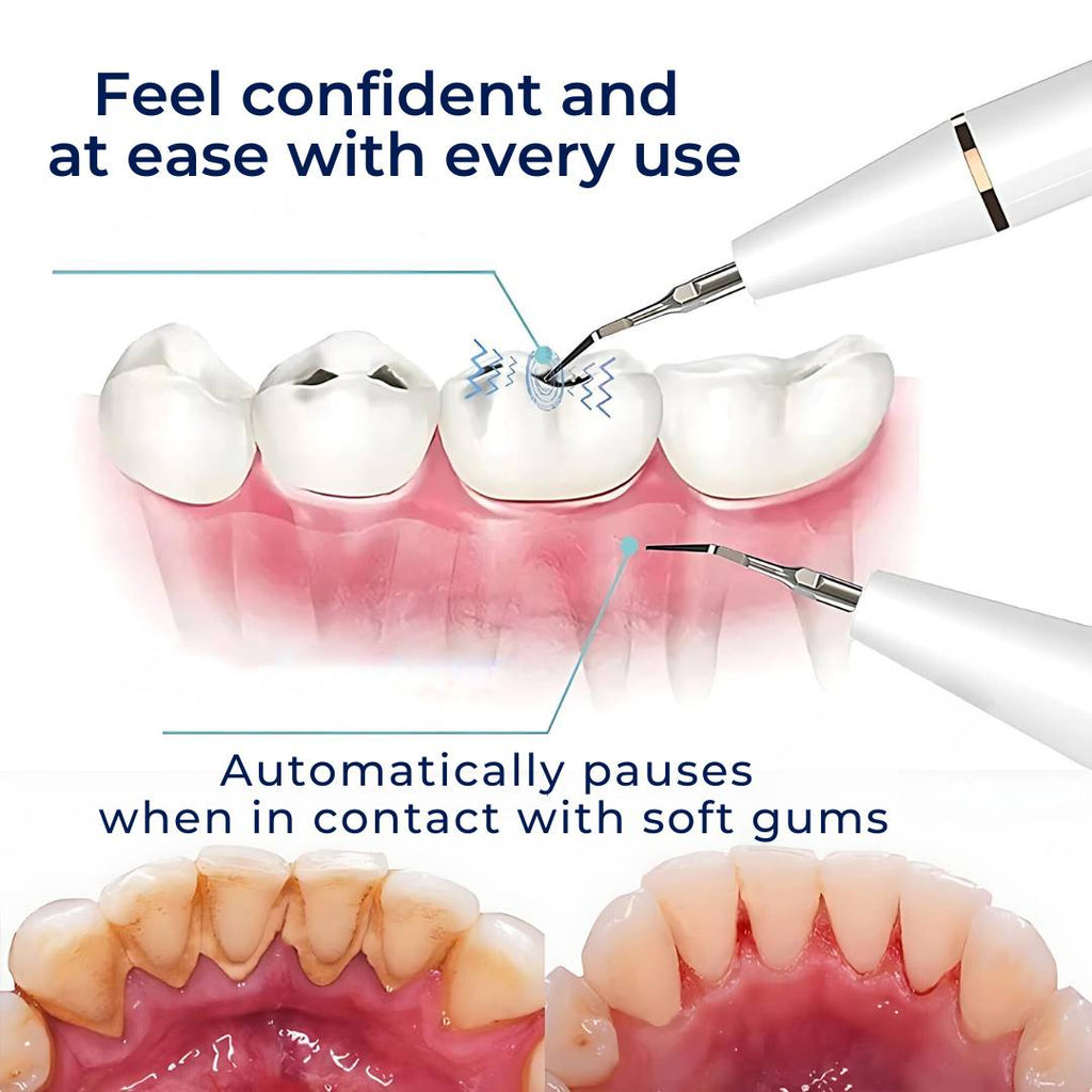 PlaqueFree Plaque Remover for teeth | Ultrasonic Teeth Cleaner - Tartar Remover from Home - Deep Teeth Cleaning and Polish