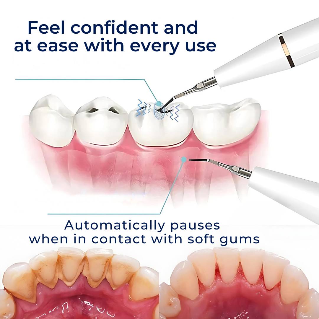 PlaqueFree Plaque Remover for teeth | Ultrasonic Teeth Cleaner - Tartar Remover from Home - Deep Teeth Cleaning and Polish