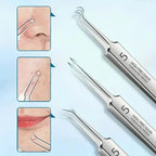 Precision Tweezer Set – Acknowledge tools made of stainless steel for flawless skin