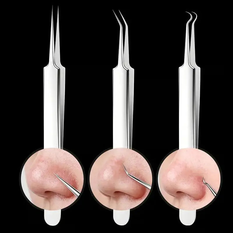 Precision Tweezer Set – Acknowledge tools made of stainless steel for flawless skin