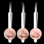 Precision Tweezer Set – Acknowledge tools made of stainless steel for flawless skin