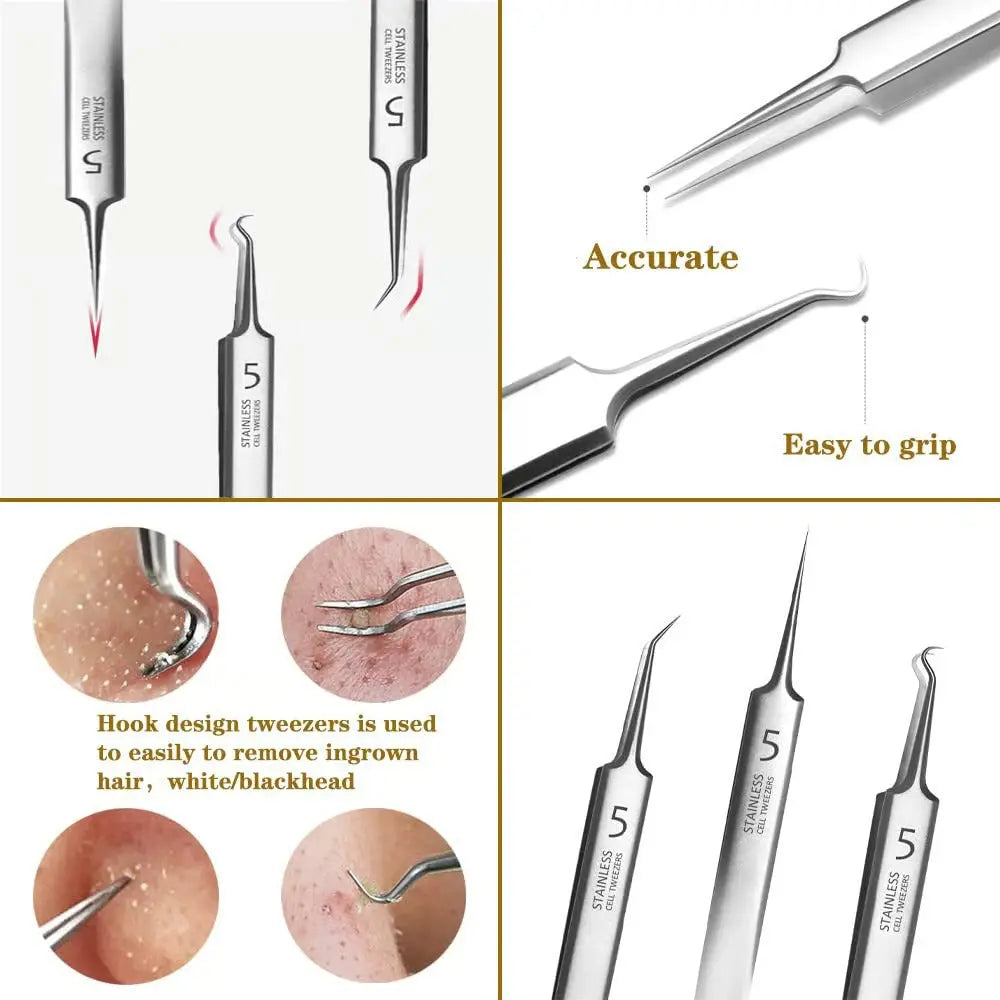 Precision Tweezer Set – Acknowledge tools made of stainless steel for flawless skin