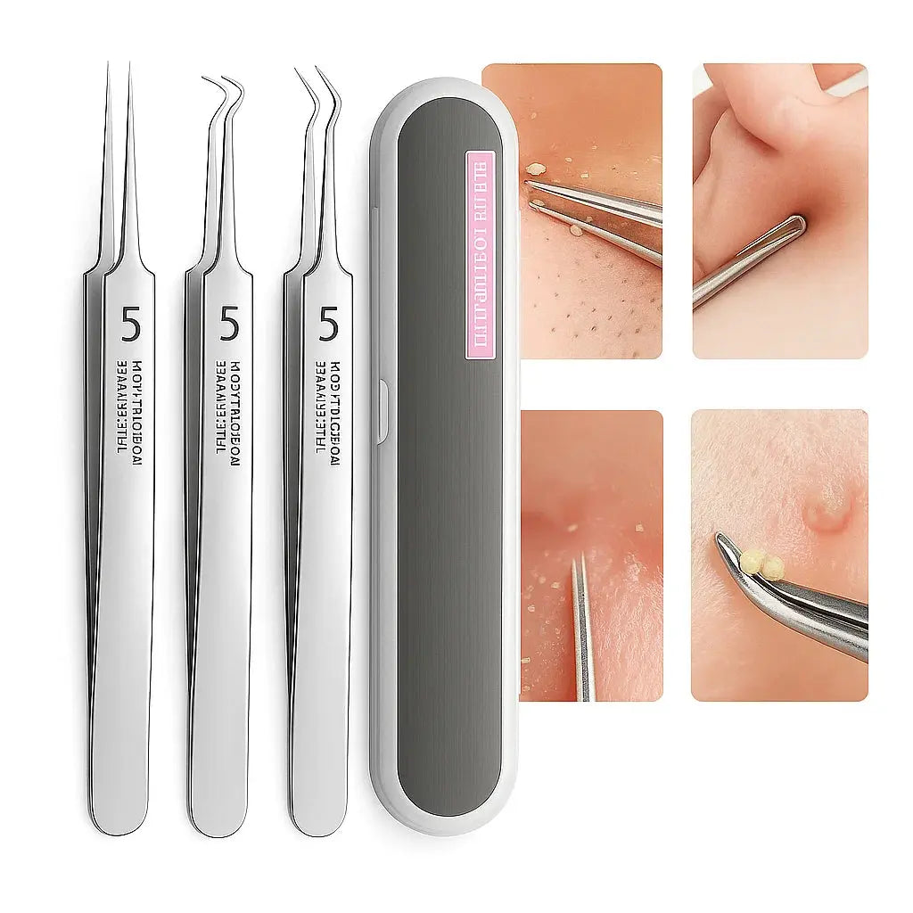 Precision Tweezer Set – Acknowledge tools made of stainless steel for flawless skin