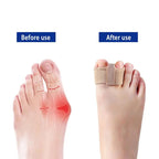 Toe Separators for Bunions & Misalignment | Elastic Nylon + SEBS | Pain Relief & Posture Support