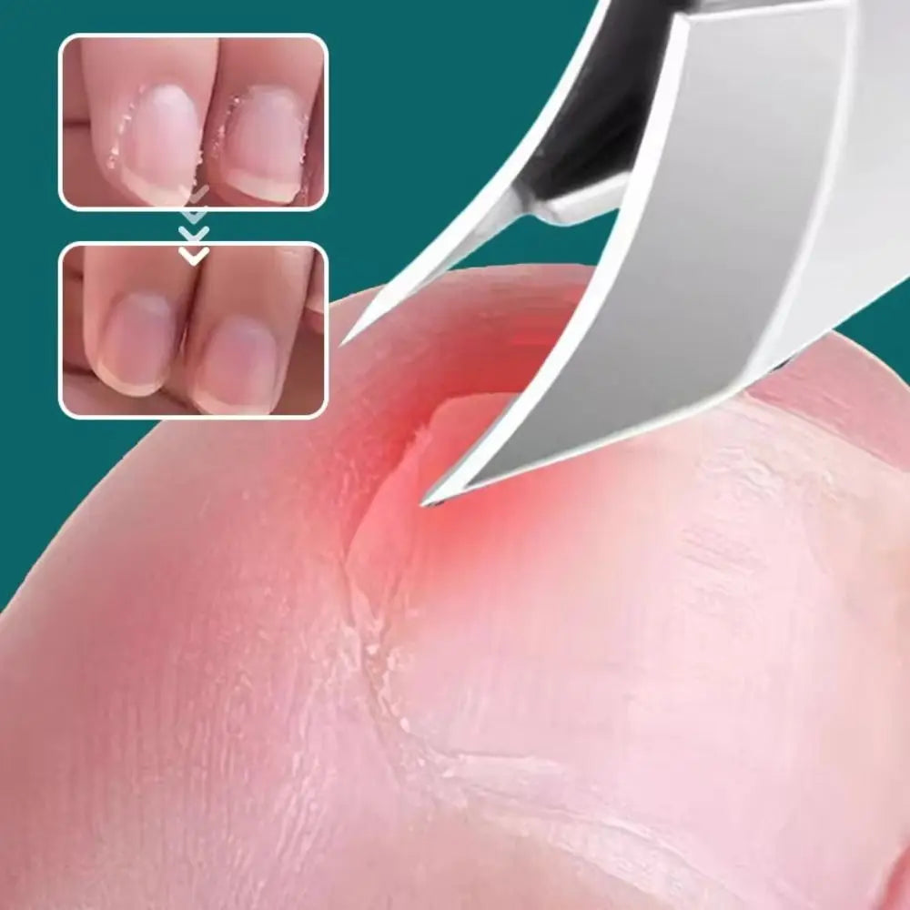 Curved Edge Sharp Ingrown Nail Clipper
