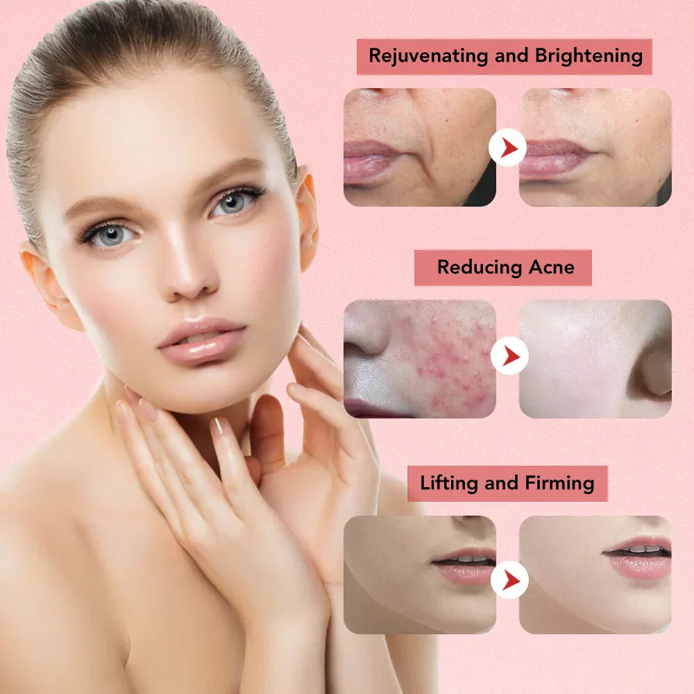 Aetheris™ | Ultrasonic Skin Lifting Tool | Facial Sculpting Device for Anti-Aging & Skin Tightening