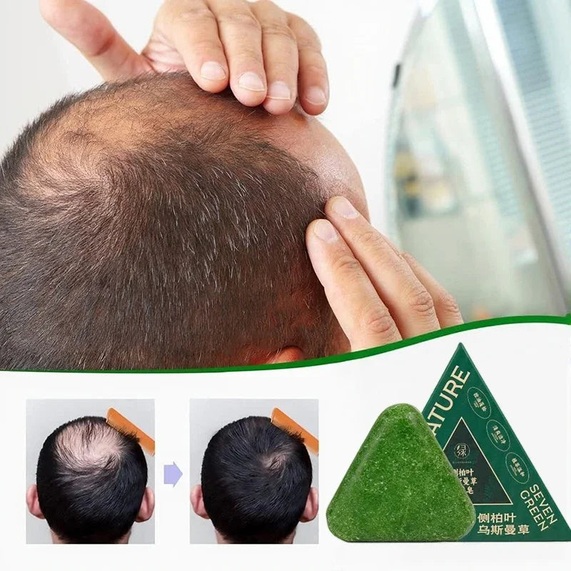 Herbal Anti-Hair Loss Shampoo Bar