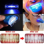 LED Teeth Whitening Light for Home Oral Care