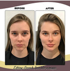 Elastic Face Lifting Band