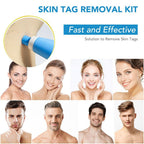 Skin spot remover for warts & skin tags