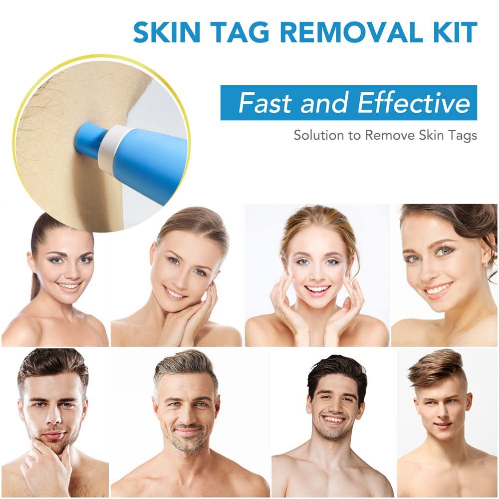 Skin spot remover for warts & skin tags