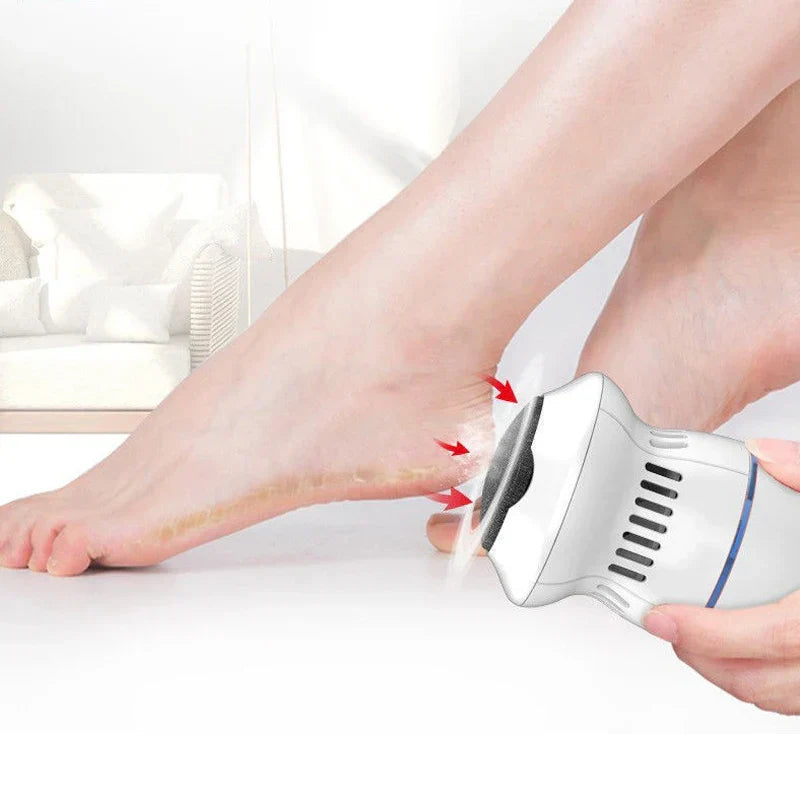 Electric Professional Callus Remover