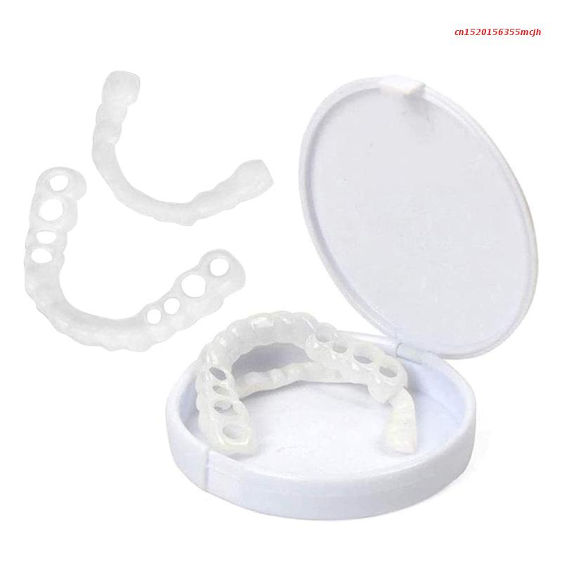 SmileSnap - Always the perfect smile with these veneers