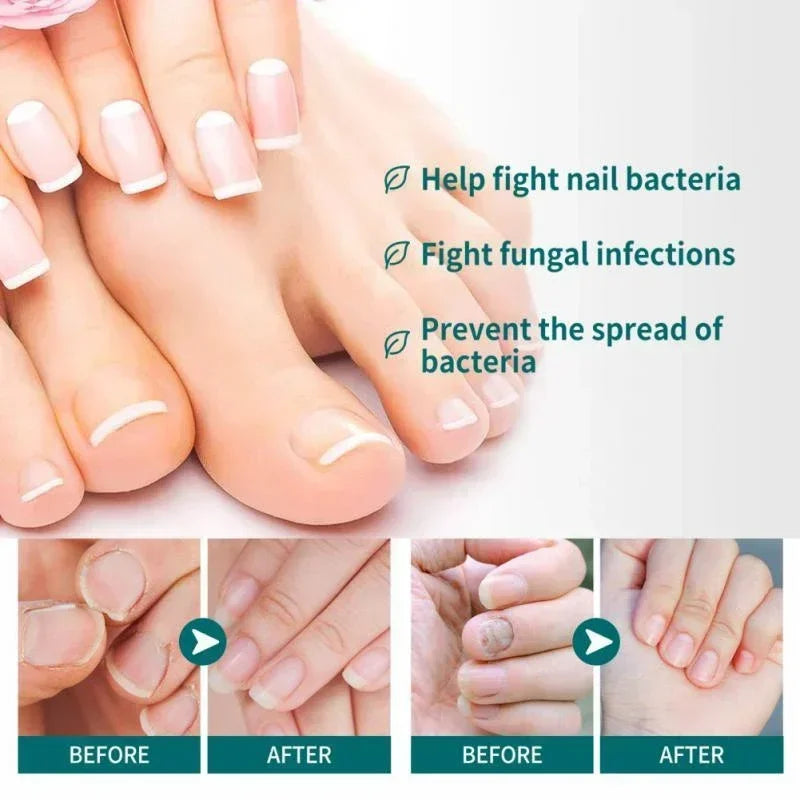 Nail Fungus Defender Serum