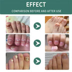 Nail Fungus Defender Serum