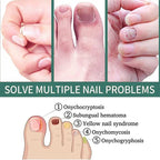 Nail Fungus Defender Serum