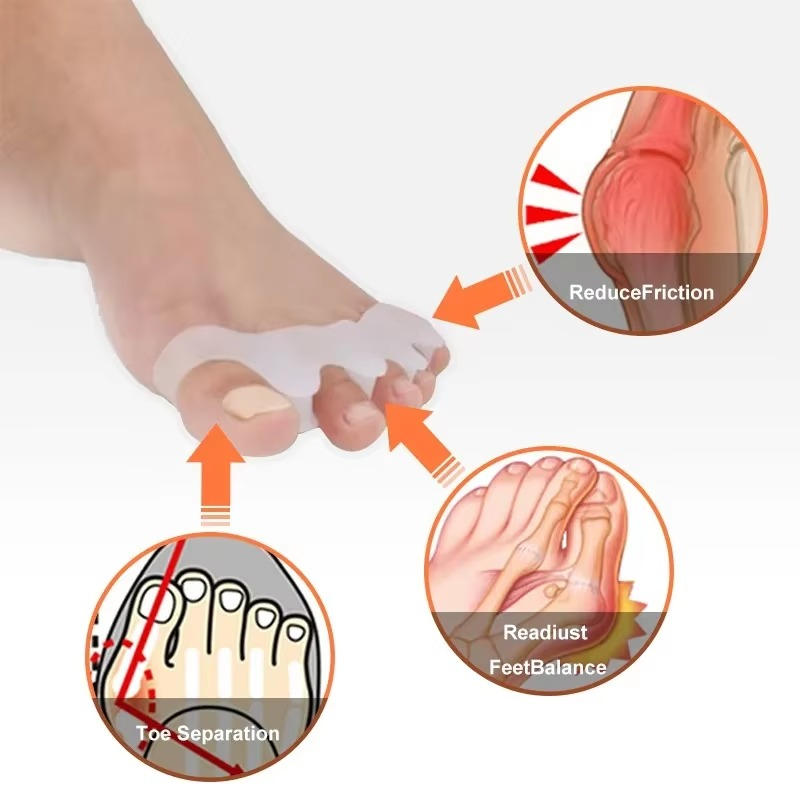 Soft Silicone Toe Separators for Bunion Relief and Alignment, 1 Pair