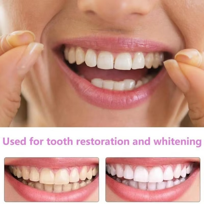 2PCS Snap-On Veneer Dentures for Men and Women, Instant Temporary Tooth Cover for a Confident Smile