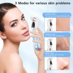 Acne Black Head Deep Clean Removal
